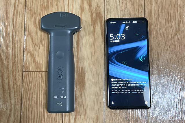 ポータブルエコー